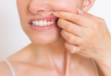 A Closer Look At Advanced Treatment Options For Periodontal Health