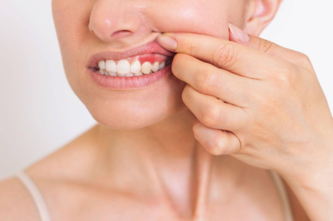 A Closer Look At Advanced Treatment Options For Periodontal Health